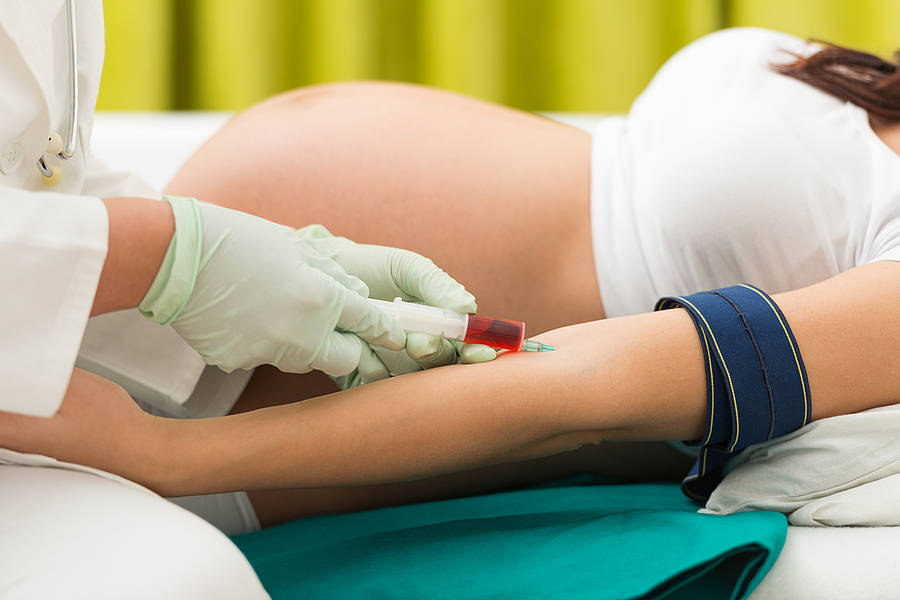 Какая норма билирубина у женщин при беременности