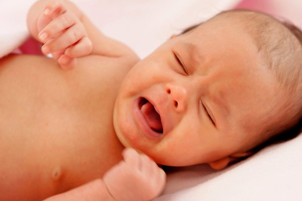 Симптомы гипербилирубинемии у новорожденных