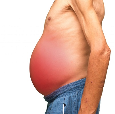 Симптомы жирового гепатоза