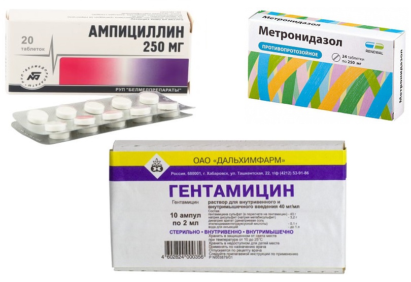 Антибиотики при обострении холецистита